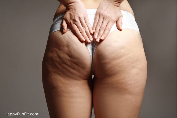 Cellulite on ladies bottom and thighs